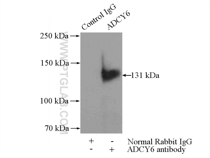 Immunoprecipitation (IP) experiment of mouse brain tissue using ADCY6 Polyclonal antibody (14616-1-AP)