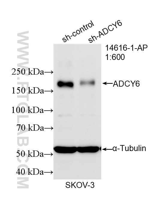 WB analysis of SKOV-3 using 14616-1-AP Western Blot (WB) analysis of SKOV-3 cells using ADCY6 Polyclonal antibody (14616-1-AP)