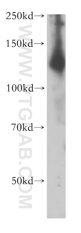 Western Blot (WB) analysis of human brain tissue using ADCY6 Polyclonal antibody (14616-1-AP)