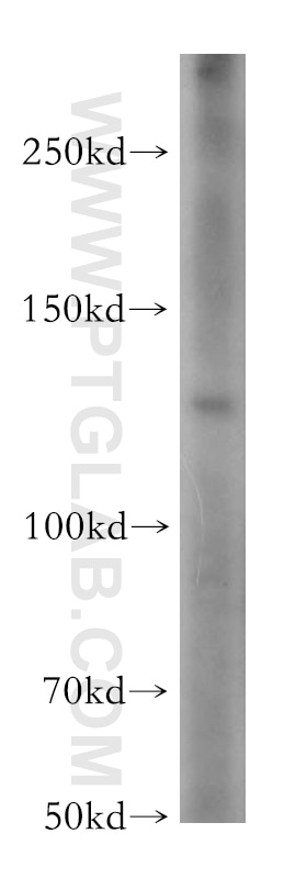 Western Blot (WB) analysis of mouse brain tissue using ADCY6 Polyclonal antibody (14616-1-AP)