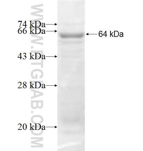 ADCY6 fusion protein Ag6218 SDS-PAGE