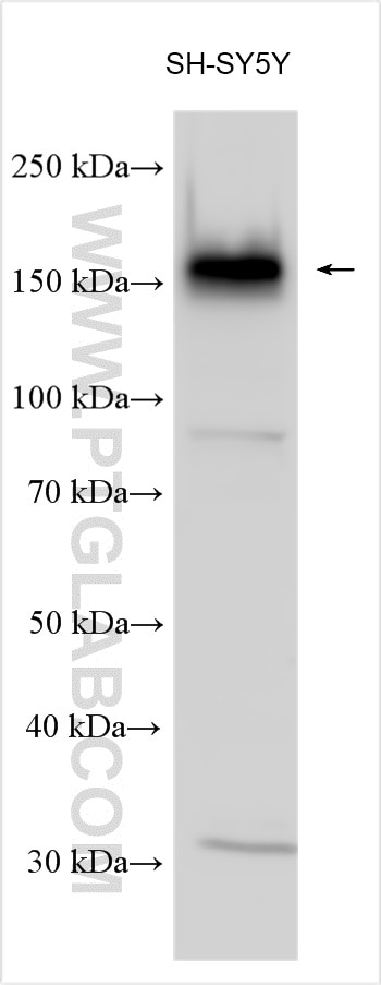 Western Blot (WB) analysis of various lysates using ADCY8 Polyclonal antibody (30171-1-AP)