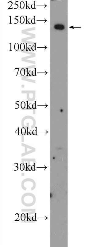 Western Blot (WB) analysis of Neuro-2a cells using ADCY8 Polyclonal antibody (55065-1-AP)