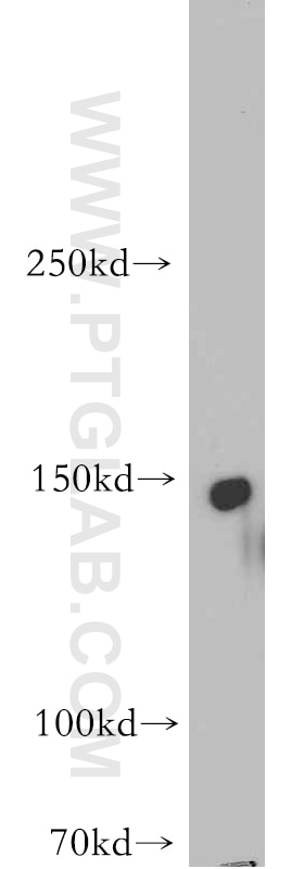 Western Blot (WB) analysis of SH-SY5Y cells using ADCY8 Polyclonal antibody (55065-1-AP)