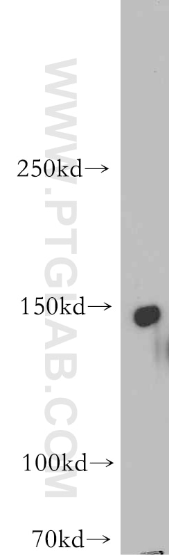 Western Blot (WB) analysis of SH-SY5Y cells using ADCY8 Polyclonal antibody (55065-1-AP)