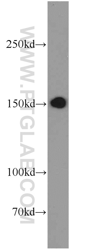Western Blot (WB) analysis of Neuro-2a cells using ADCY8 Polyclonal antibody (55065-1-AP)