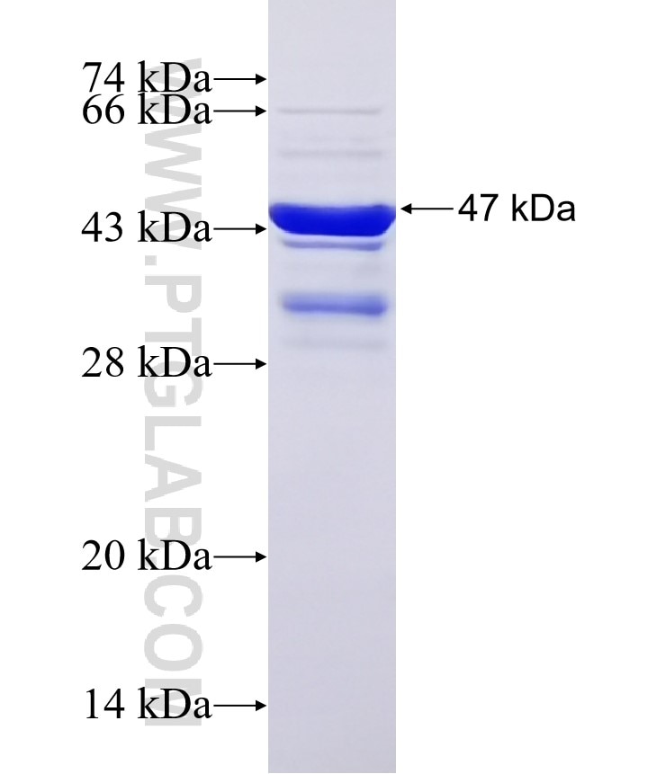 ADCY8 fusion protein Ag32901 SDS-PAGE