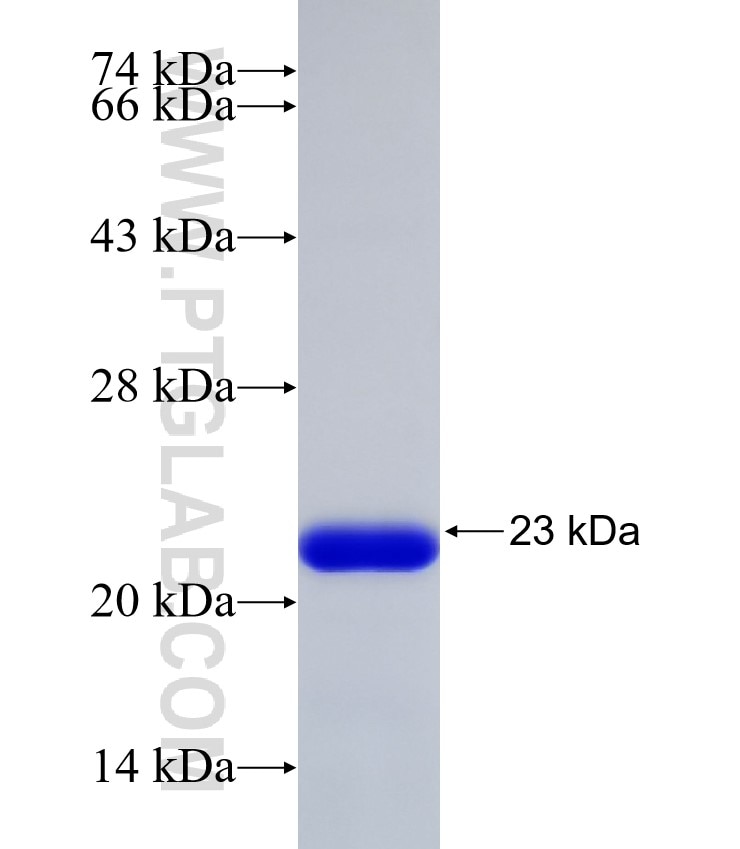 ADCY8 fusion protein Ag32914 SDS-PAGE