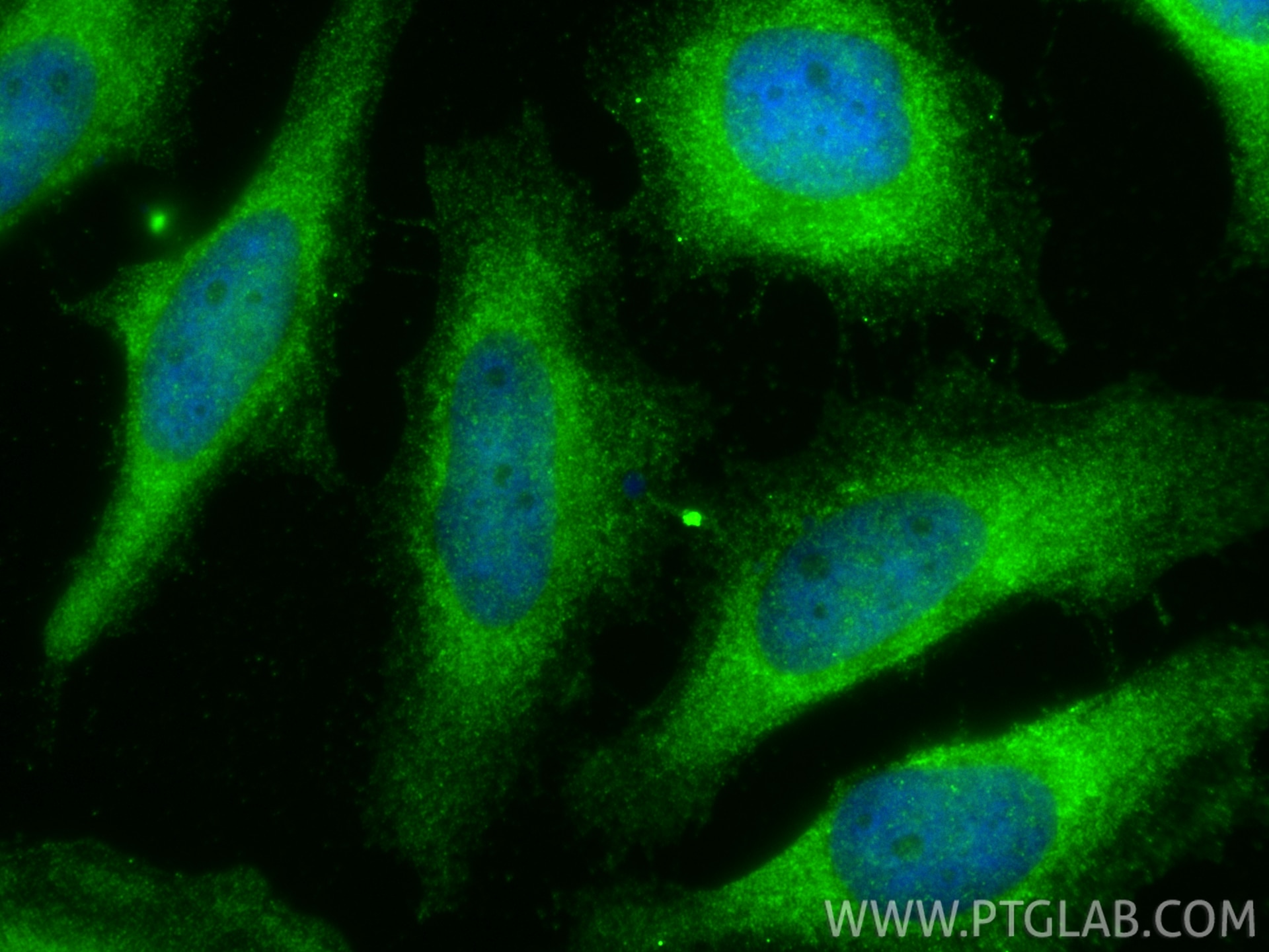 IF Staining of HeLa using 18163-1-AP Immunofluorescence (IF) / fluorescent staining of HeLa cells using ADCYAP1 Polyclonal antibody (18163-1-AP)