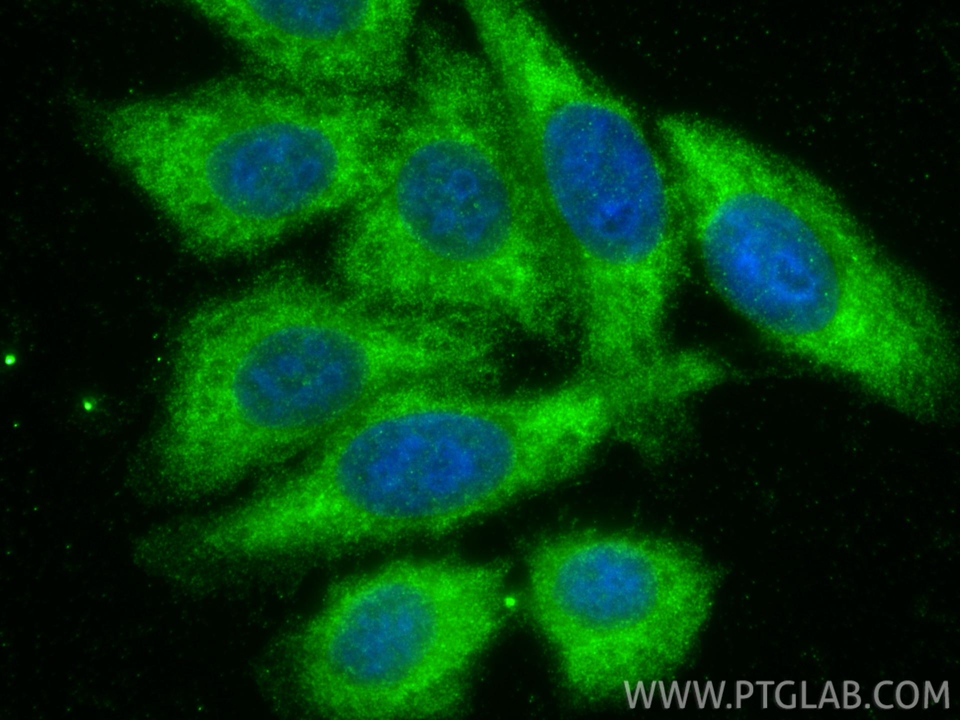 IF Staining of HepG2 using 18163-1-AP Immunofluorescence (IF) / fluorescent staining of HepG2 cells using ADCYAP1 Polyclonal antibody (18163-1-AP)