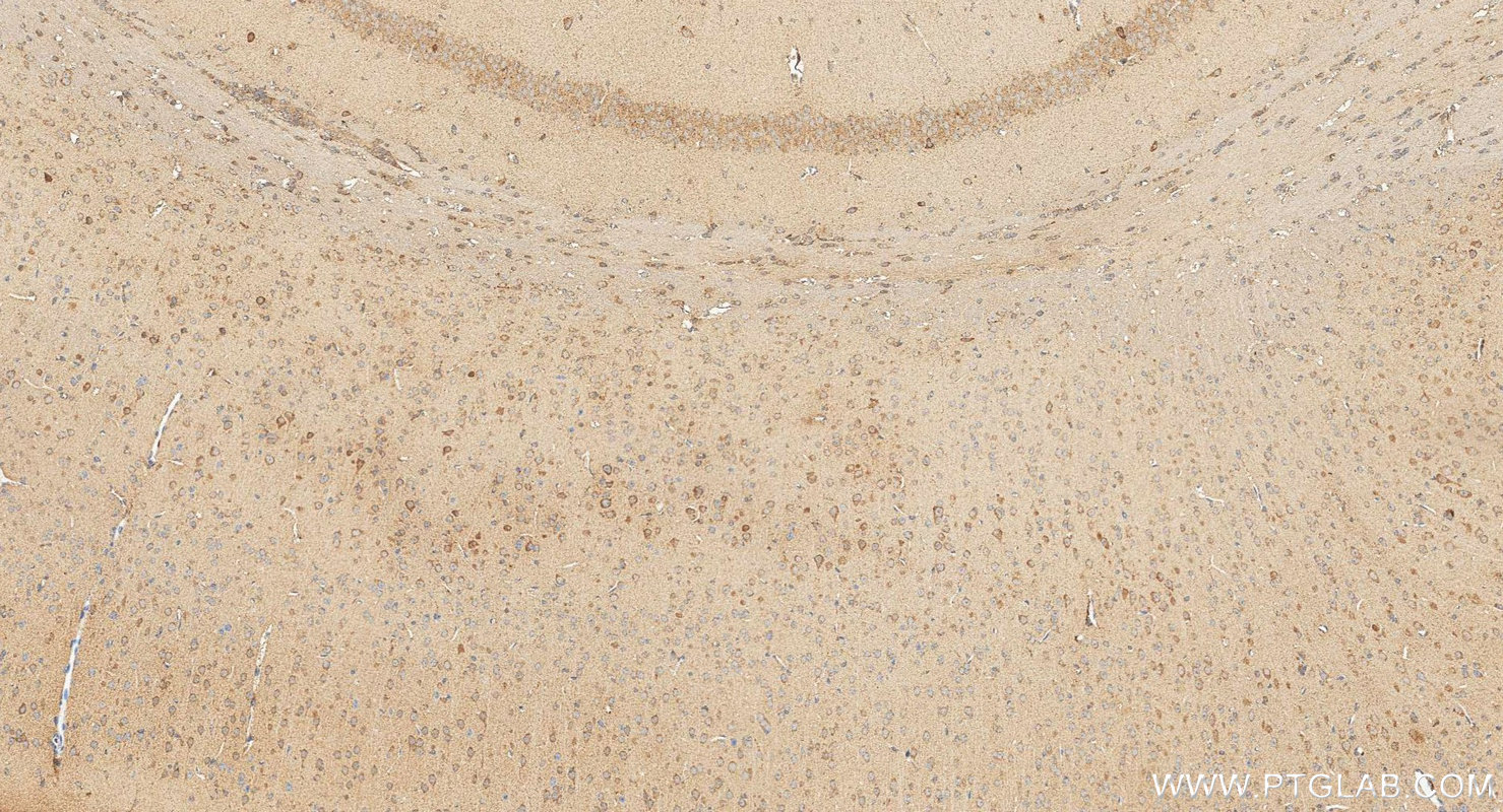 IHC staining of mouse brain using 18163-1-AP Immunohistochemistry (IHC) staining of mouse brain tissue using ADCYAP1 Polyclonal antibody (18163-1-AP)