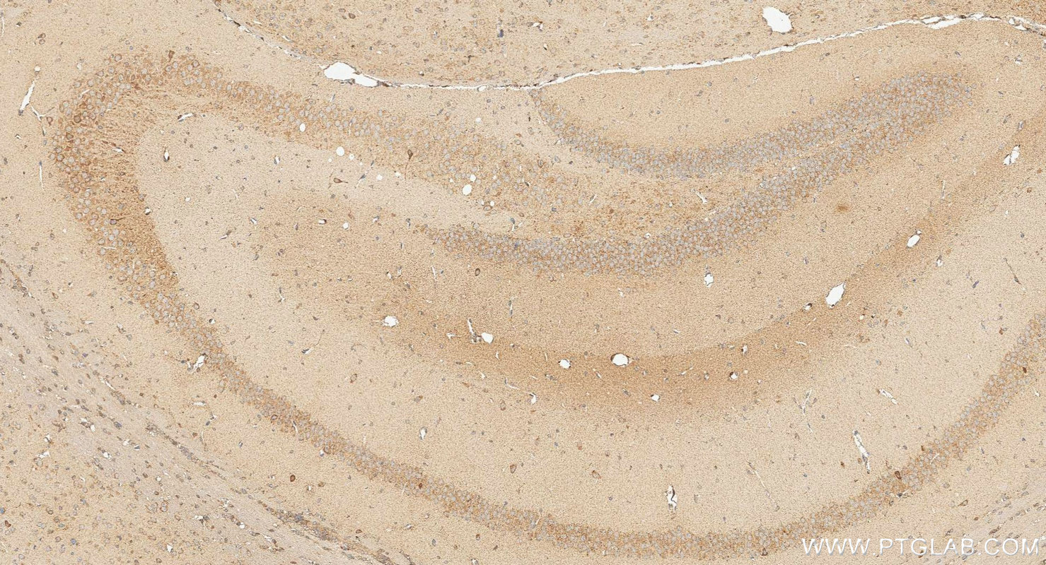 IHC staining of mouse brain using 18163-1-AP Immunohistochemistry (IHC) staining of mouse brain tissue using ADCYAP1 Polyclonal antibody (18163-1-AP)
