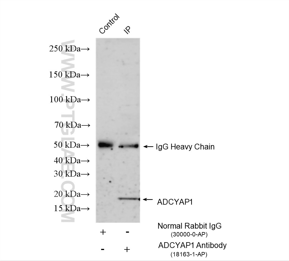 IP experiment of HeLa using 18163-1-AP Immunoprecipitation (IP) experiment of HeLa cells using ADCYAP1 Polyclonal antibody (18163-1-AP)