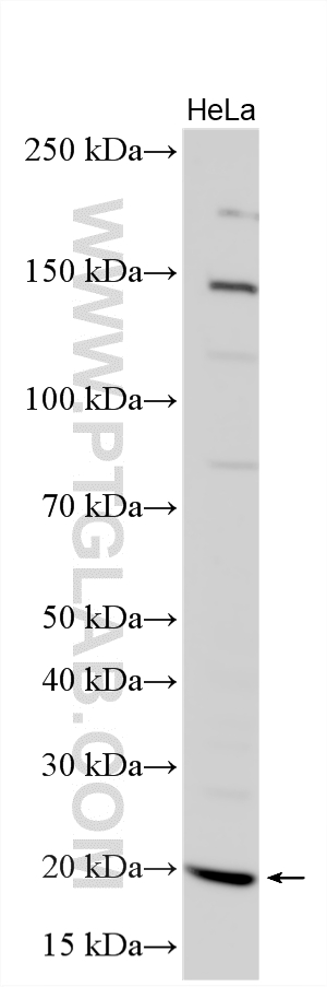WB analysis using 18163-1-AP Western Blot (WB) analysis of various lysates using ADCYAP1 Polyclonal antibody (18163-1-AP)