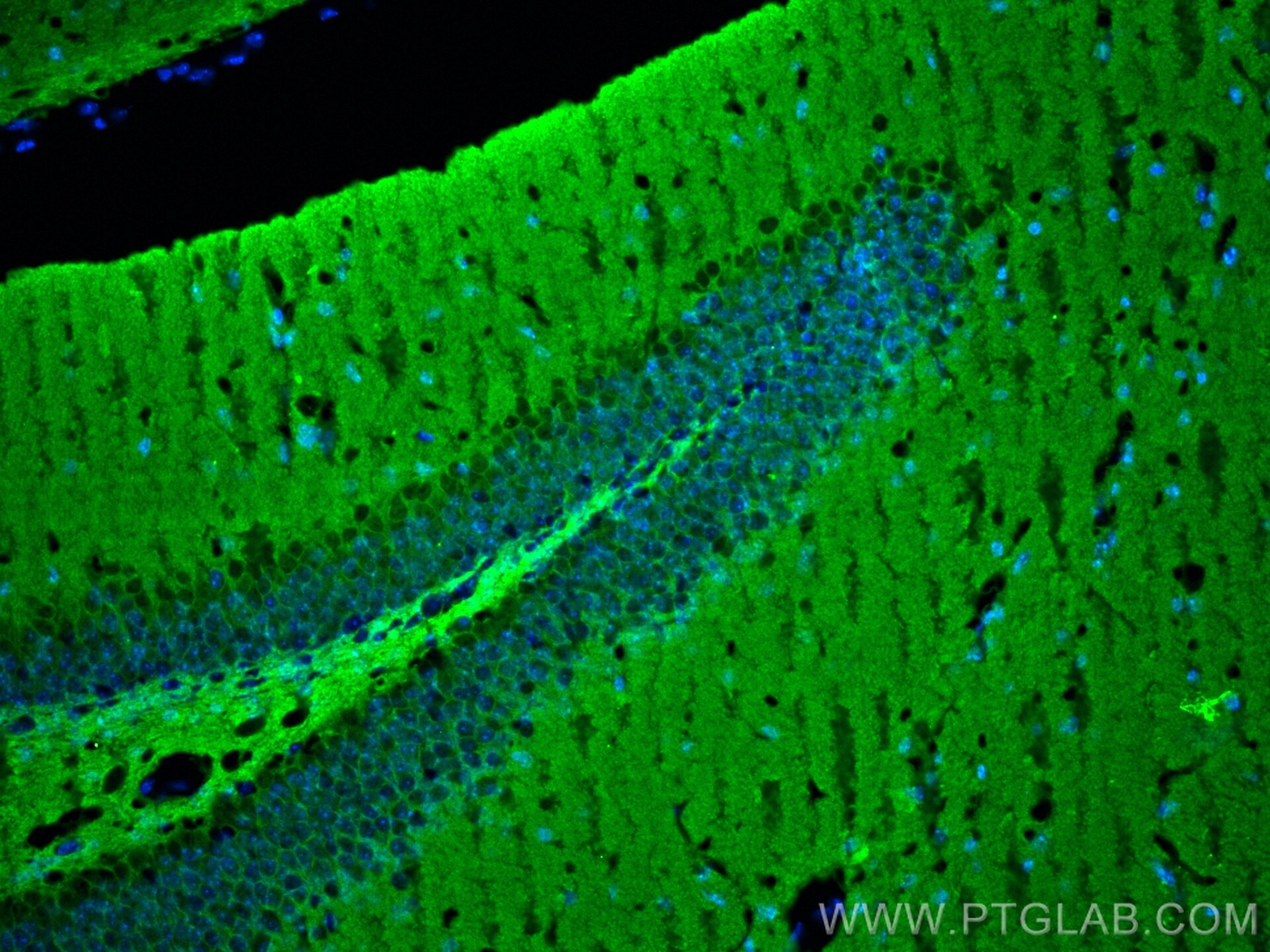 Immunofluorescence (IF) / fluorescent staining of mouse brain tissue using Alpha Adducin Polyclonal antibody (10791-1-AP)