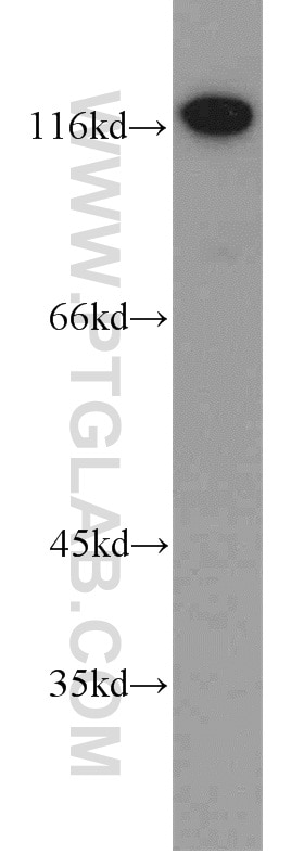 Western Blot (WB) analysis of K-562 cells using Alpha Adducin Polyclonal antibody (10791-1-AP)