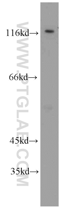 Western Blot (WB) analysis of mouse testis tissue using Alpha Adducin Polyclonal antibody (10791-1-AP)