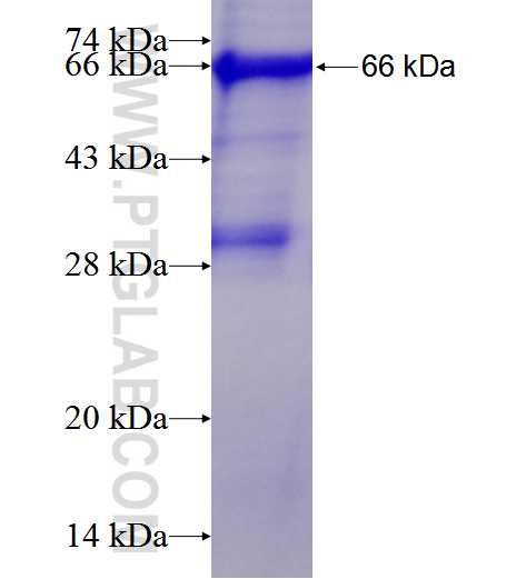 ADD1 fusion protein Ag1245 SDS-PAGE