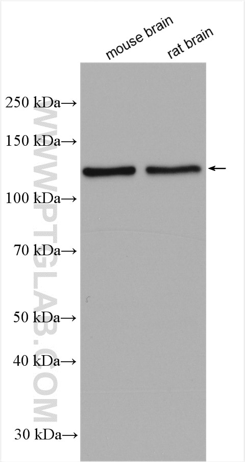 Western Blot (WB) analysis of various lysates using Beta Adducin Polyclonal antibody (14640-1-AP)