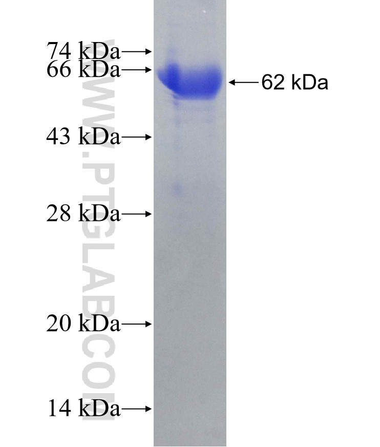ADD2 fusion protein Ag6223 SDS-PAGE