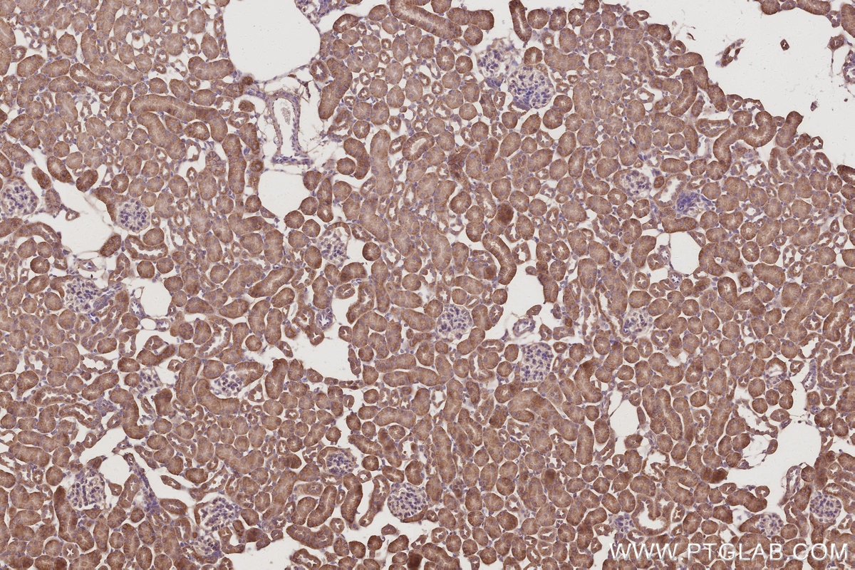 Immunohistochemistry (IHC) staining of mouse kidney tissue using Gamma Adducin Polyclonal antibody (17585-1-AP)