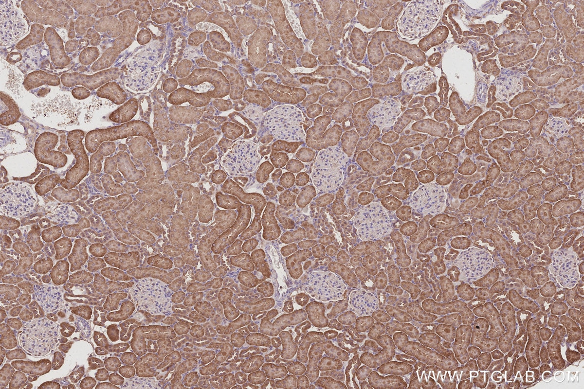Immunohistochemistry (IHC) staining of rat kidney tissue using Gamma Adducin Polyclonal antibody (17585-1-AP)