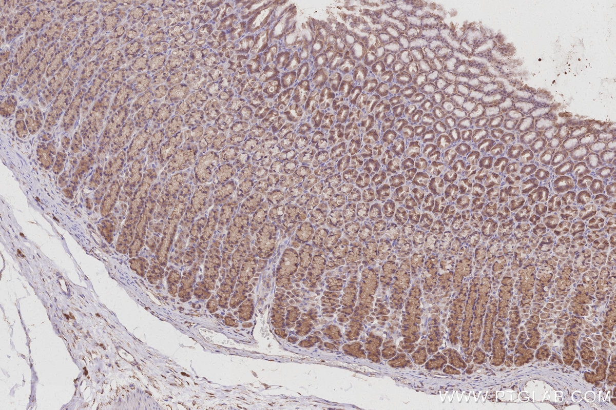 Immunohistochemistry (IHC) staining of rat stomach tissue using Gamma Adducin Polyclonal antibody (17585-1-AP)