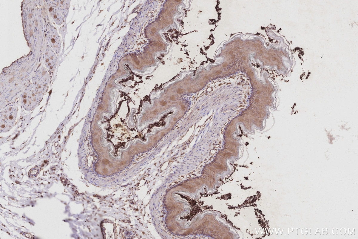 Immunohistochemistry (IHC) staining of rat stomach tissue using Gamma Adducin Polyclonal antibody (17585-1-AP)
