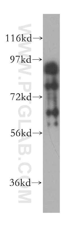 Western Blot (WB) analysis of mouse kidney tissue using Gamma Adducin Polyclonal antibody (17585-1-AP)