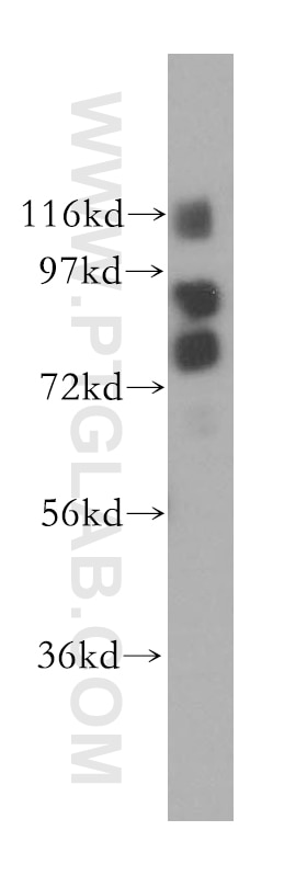 Western Blot (WB) analysis of K-562 cells using Gamma Adducin Polyclonal antibody (17585-1-AP)