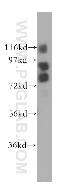 WB analysis of K-562 using 17585-1-AP