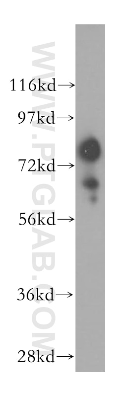 Western Blot (WB) analysis of NIH/3T3 cells using Gamma Adducin Polyclonal antibody (17585-1-AP)