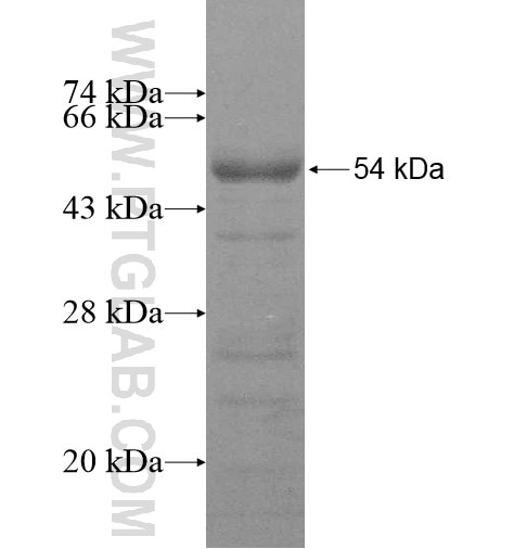 ADD3 fusion protein Ag11318 SDS-PAGE