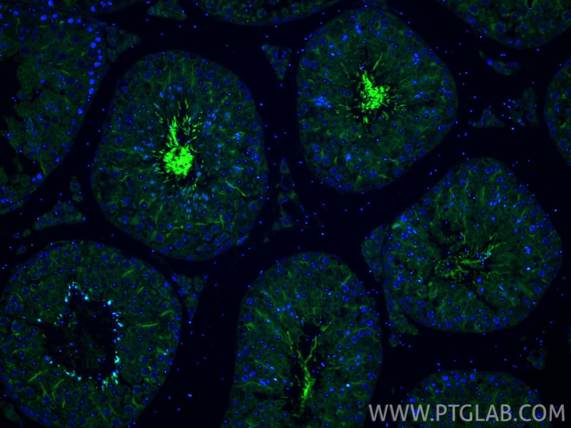 Immunofluorescence (IF) / fluorescent staining of mouse testis tissue using ADGB Polyclonal antibody (31756-1-AP)