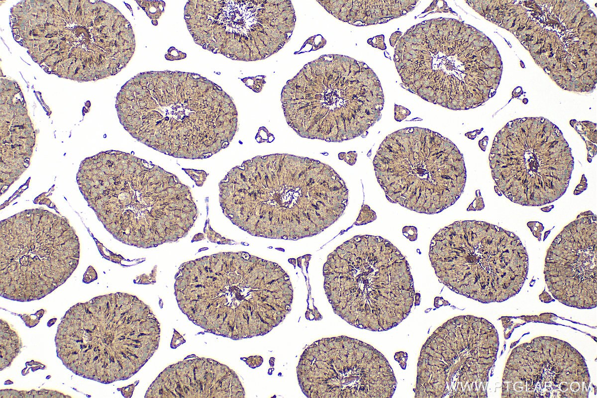 Immunohistochemistry (IHC) staining of mouse testis tissue using ADGB Polyclonal antibody (31756-1-AP)