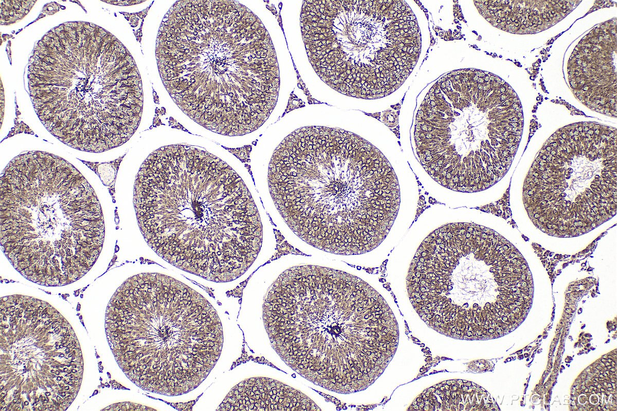 Immunohistochemistry (IHC) staining of rat testis tissue using ADGB Polyclonal antibody (31756-1-AP)