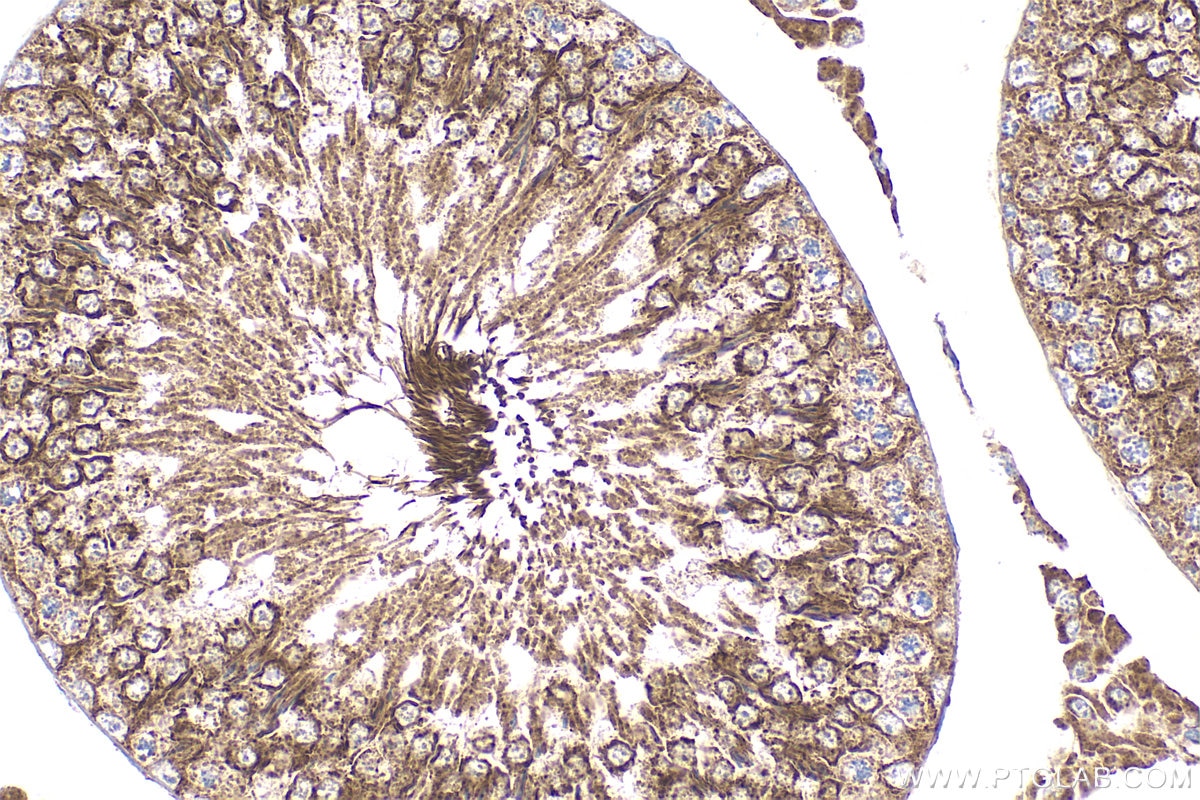 Immunohistochemistry (IHC) staining of rat testis tissue using ADGB Polyclonal antibody (31756-1-AP)