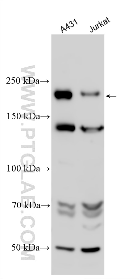 Western Blot (WB) analysis of various lysates using ADGB Polyclonal antibody (31756-1-AP)