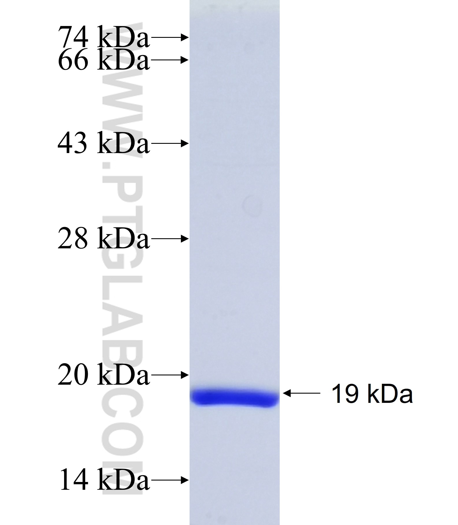 ADGRV1 fusion protein Ag34608 SDS-PAGE