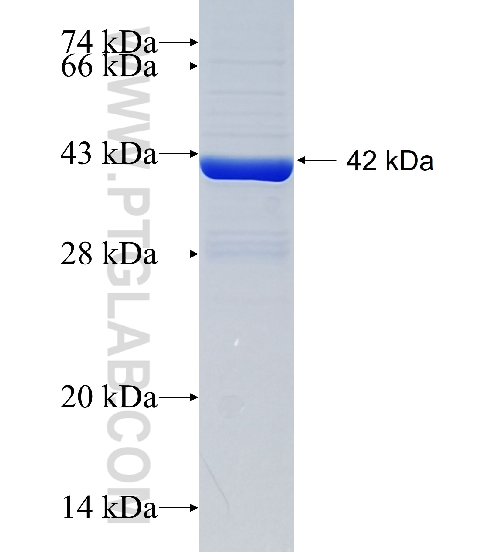 ADGRV1 fusion protein Ag34635 SDS-PAGE