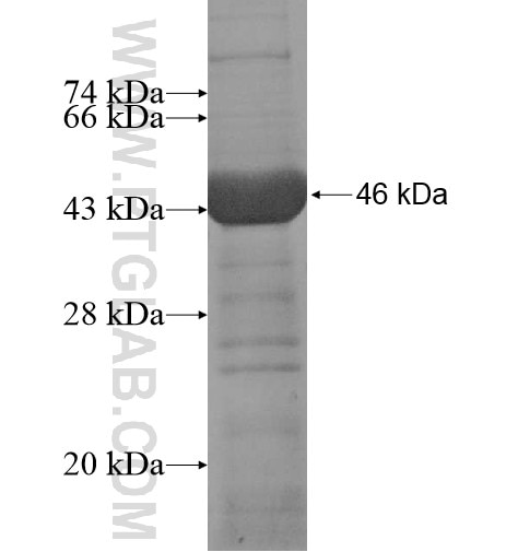ADH1A fusion protein Ag12467 SDS-PAGE
