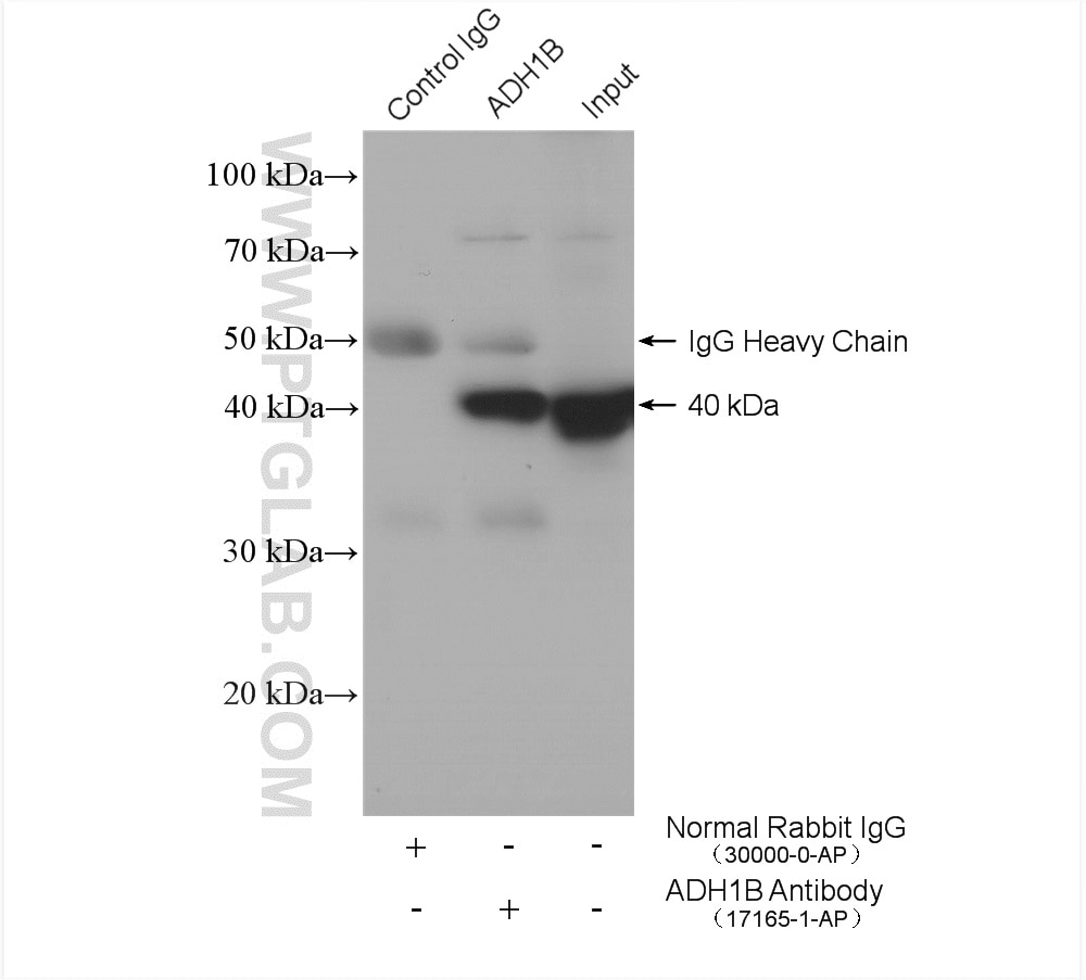 Immunoprecipitation (IP) experiment of mouse liver tissue using ADH1B Polyclonal antibody (17165-1-AP)