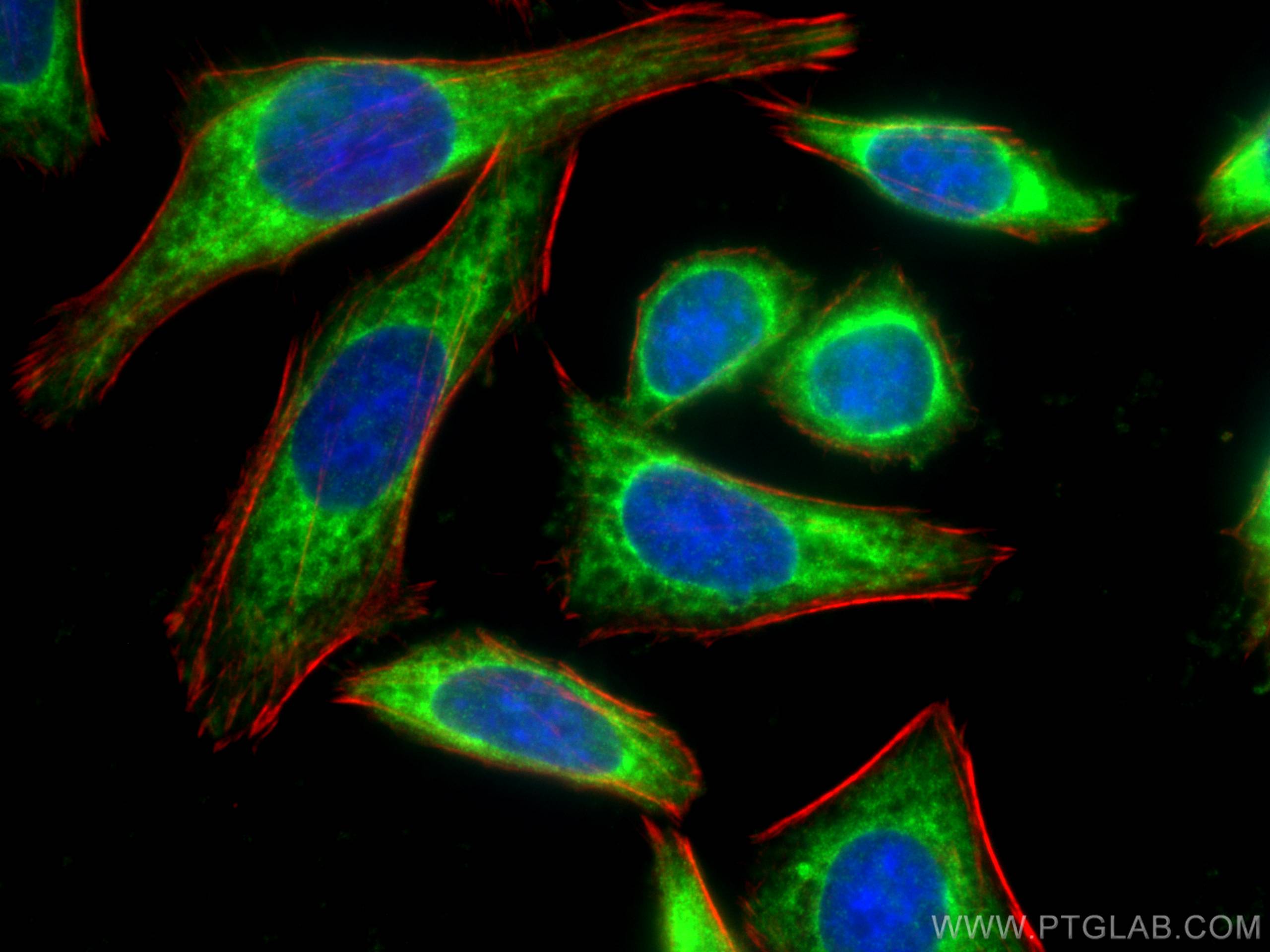 Immunofluorescence (IF) / fluorescent staining of HepG2 cells using ADH1B Monoclonal antibody (66939-1-Ig)