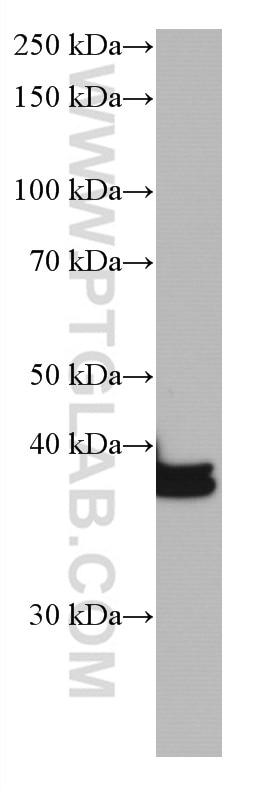 WB analysis of rat liver using 66939-1-Ig