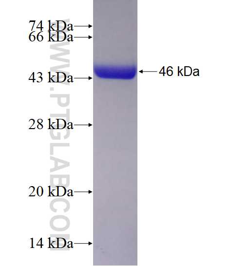 ADH1B fusion protein Ag10630 SDS-PAGE
