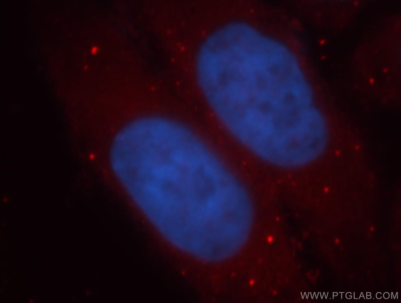 Immunofluorescence (IF) / fluorescent staining of HepG2 cells using ADH1C Polyclonal antibody (18897-1-AP)