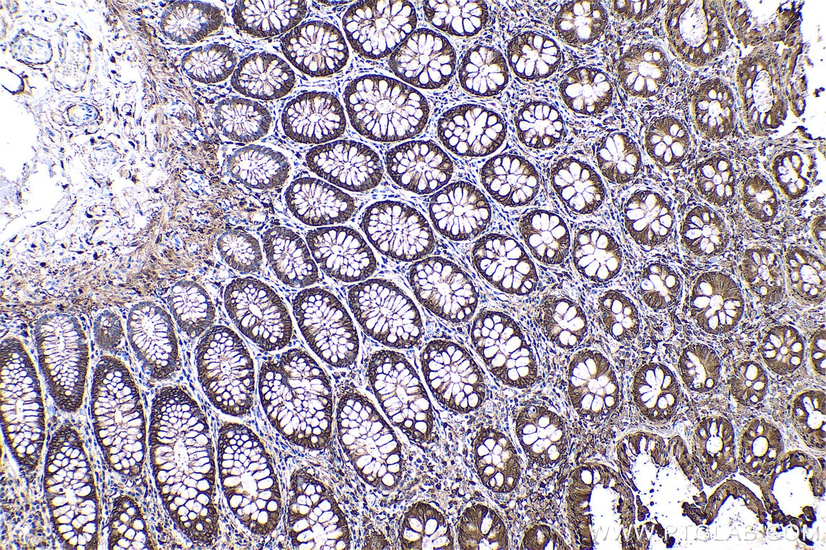 Immunohistochemistry (IHC) staining of human colon tissue using ADH1C Polyclonal antibody (18897-1-AP)