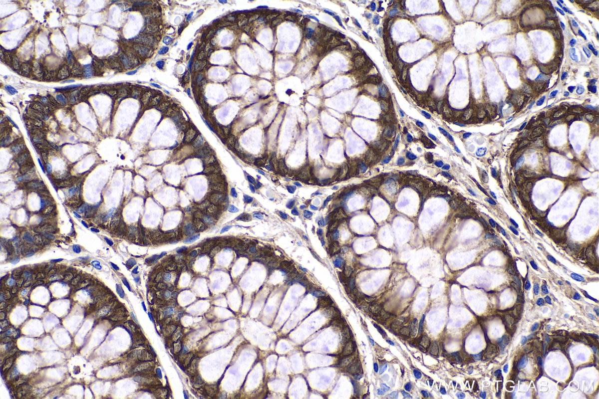 Immunohistochemistry (IHC) staining of human colon tissue using ADH1C Polyclonal antibody (18897-1-AP)