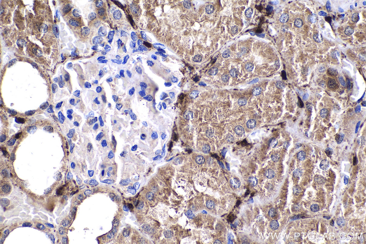 Immunohistochemistry (IHC) staining of human kidney tissue using ADH1C Polyclonal antibody (18897-1-AP)
