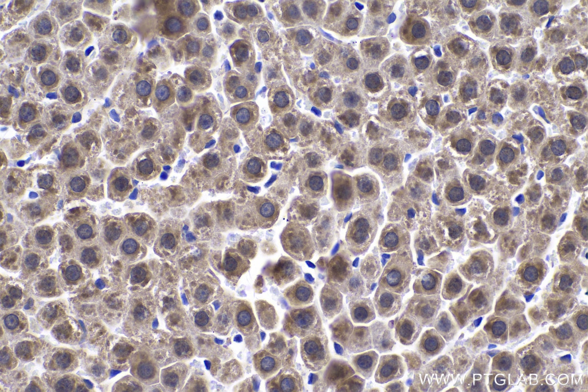 Immunohistochemistry (IHC) staining of rat liver tissue using ADH1C Polyclonal antibody (18897-1-AP)